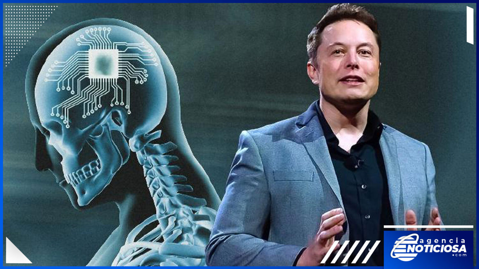 Empresa De Elon Musk Comenzará Ensayos Con Implantes Cerebrales En Humanos Agencia Noticiosa 8173